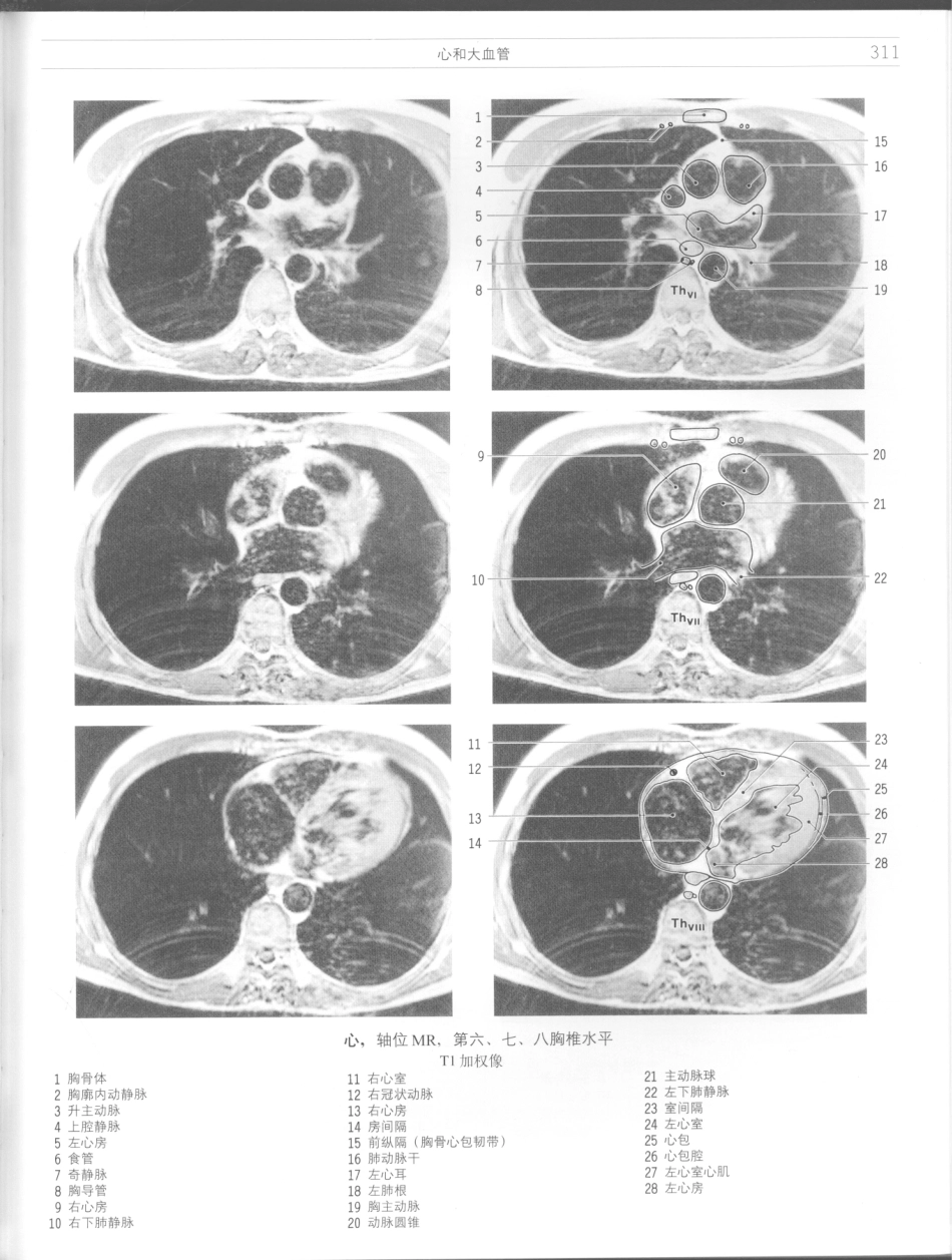 影像解剖学_11724881_313-324.pdf_第1页