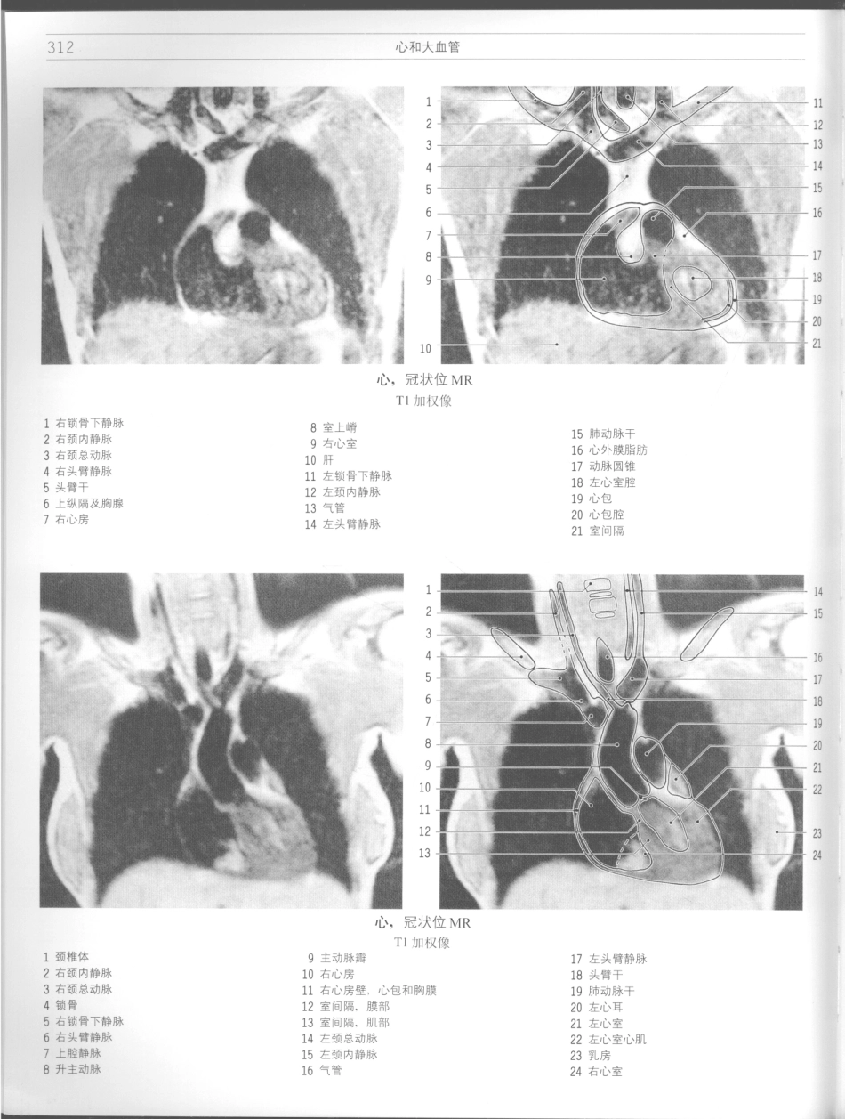影像解剖学_11724881_313-324.pdf_第2页