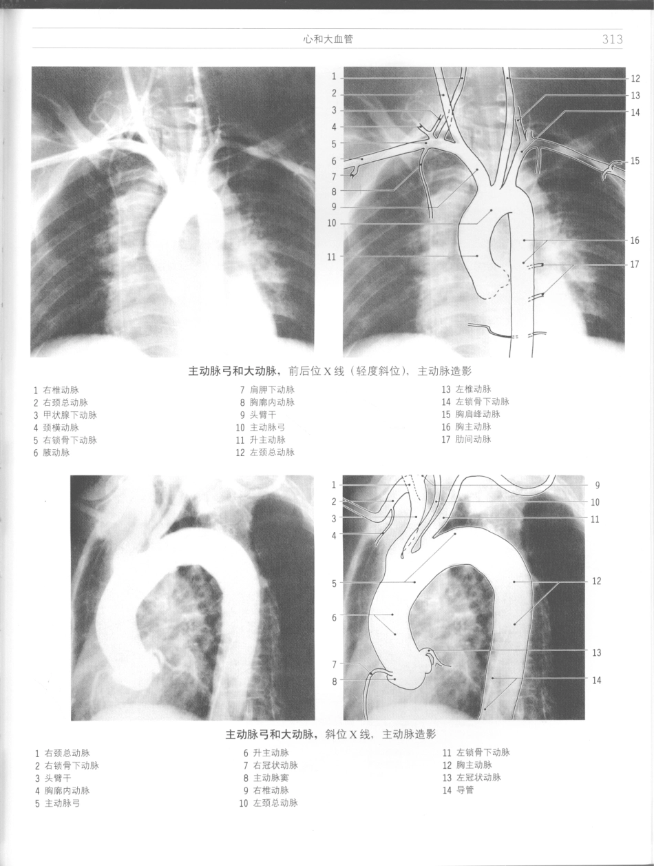 影像解剖学_11724881_313-324.pdf_第3页