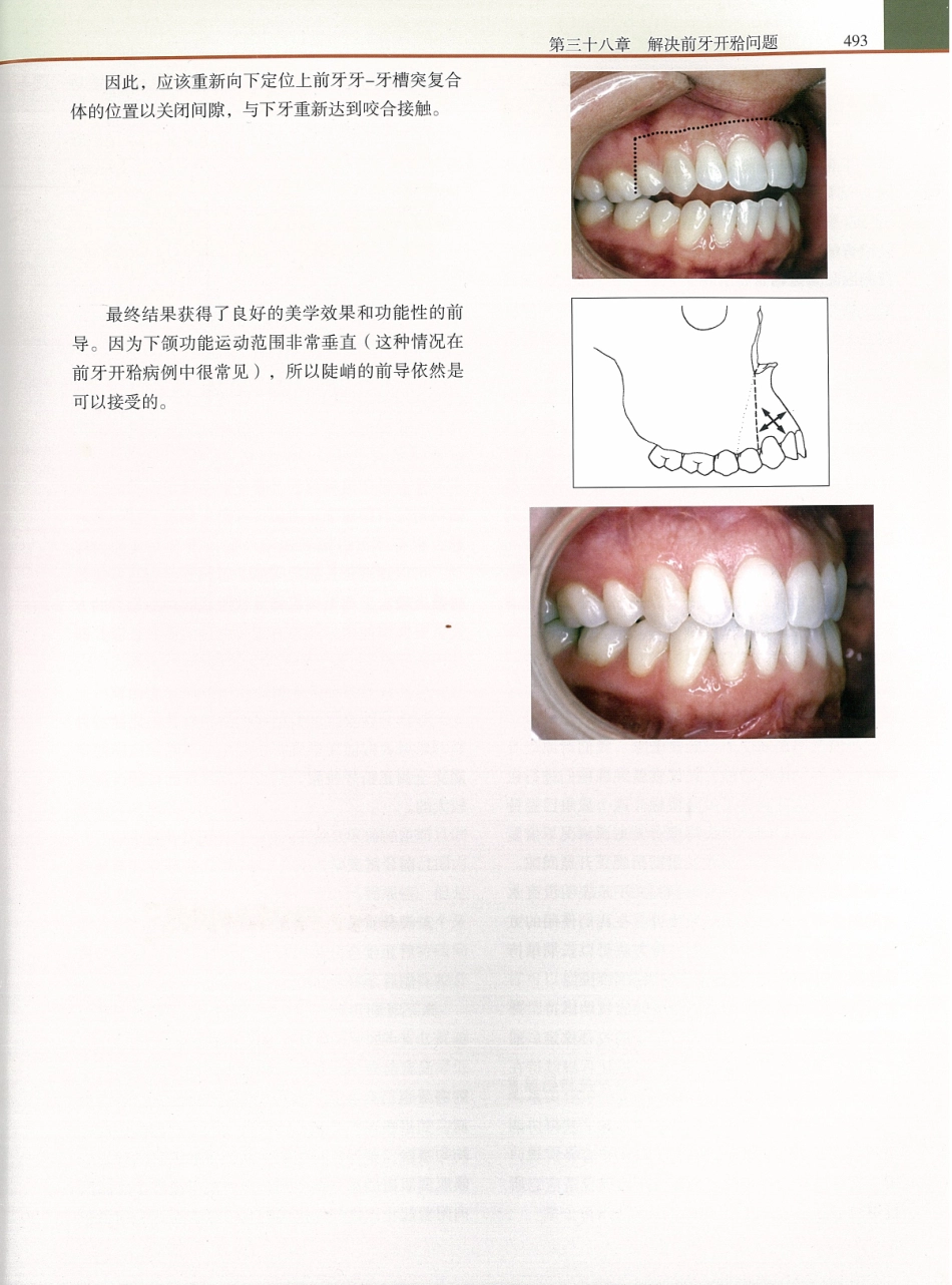 功能牙合学 从颞下颌关节到微笑设计2015年译(彩图)张豪_511-525.pdf_第1页