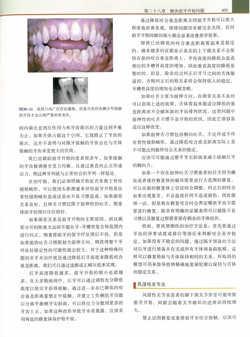 功能牙合学 从颞下颌关节到微笑设计2015年译(彩图)张豪_511-525.pdf_第3页