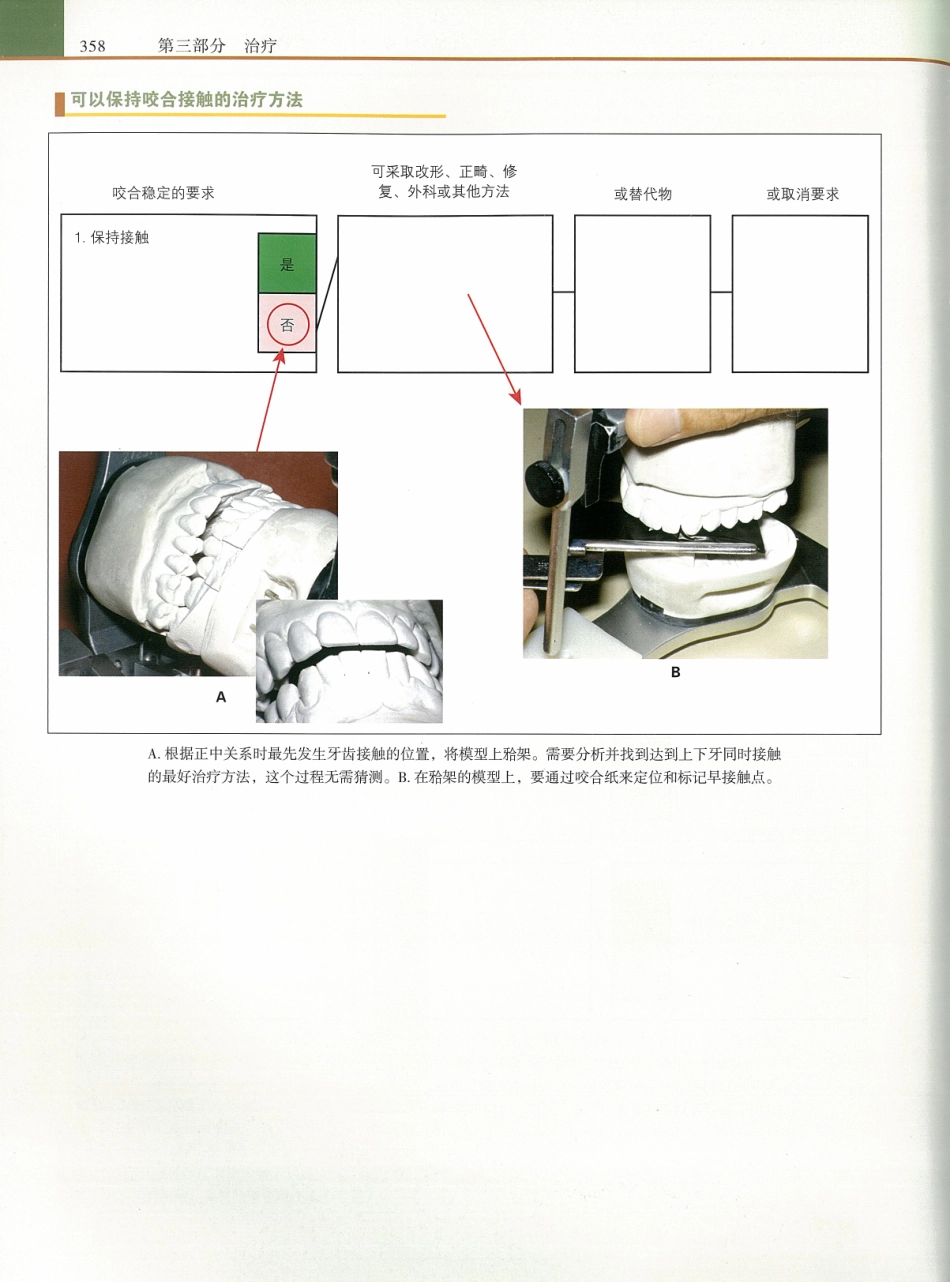 功能牙合学 从颞下颌关节到微笑设计2015年译(彩图)张豪_376-390.pdf_第1页