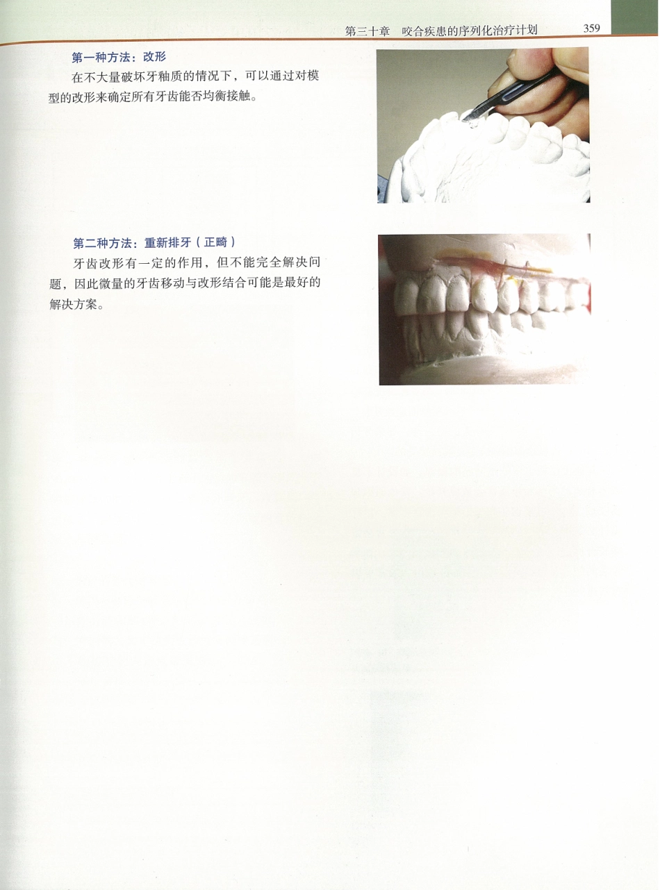 功能牙合学 从颞下颌关节到微笑设计2015年译(彩图)张豪_376-390.pdf_第2页