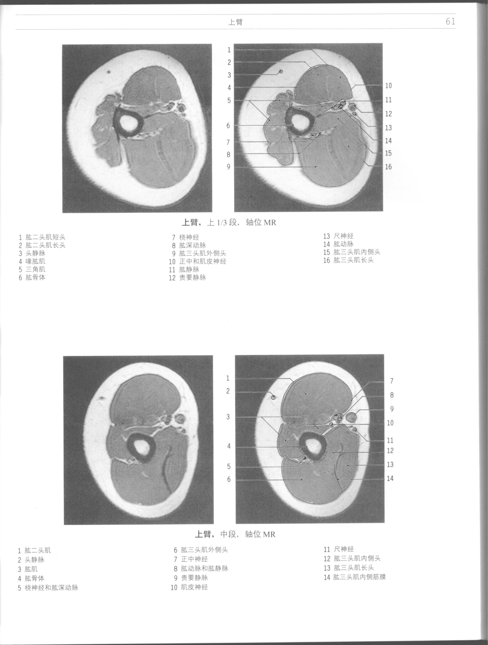影像解剖学_11724881_61-72.pdf_第3页