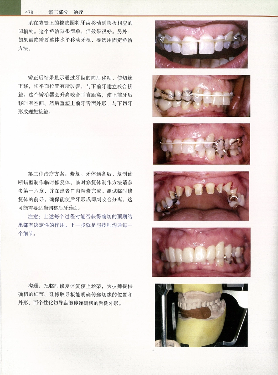 功能牙合学 从颞下颌关节到微笑设计2015年译(彩图)张豪_496-510.pdf_第1页