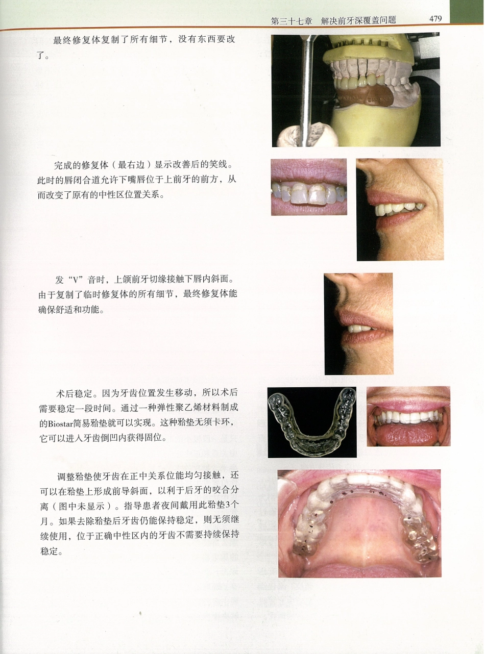功能牙合学 从颞下颌关节到微笑设计2015年译(彩图)张豪_496-510.pdf_第2页