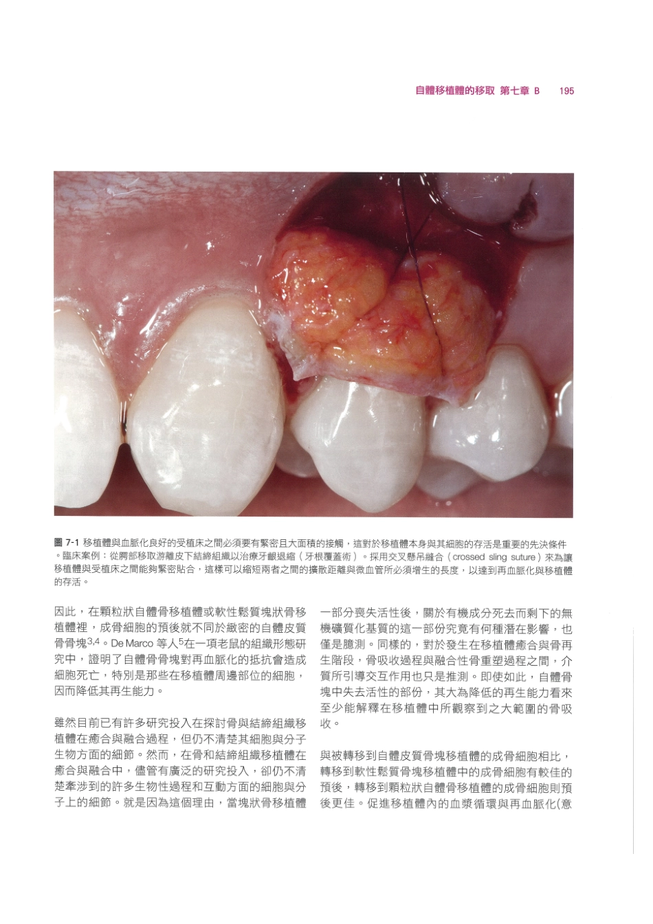 179.牙周整形美容与种植手术_209-216.pdf_第1页