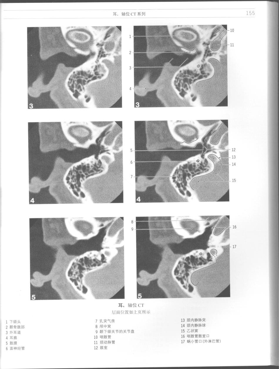 影像解剖学_11724881_157-168.pdf_第1页