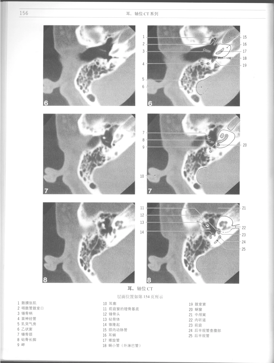 影像解剖学_11724881_157-168.pdf_第2页