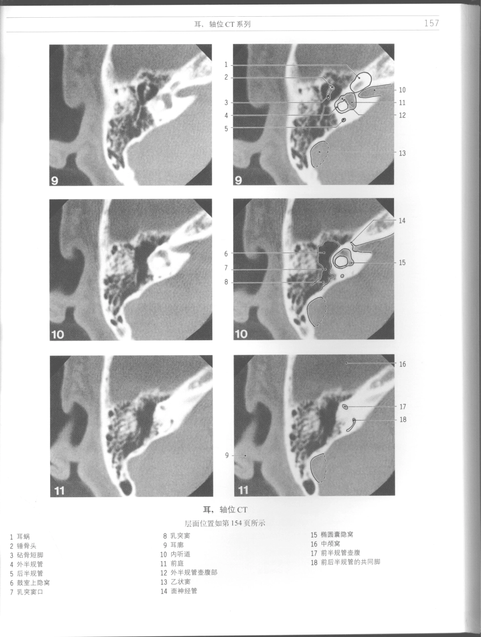 影像解剖学_11724881_157-168.pdf_第3页