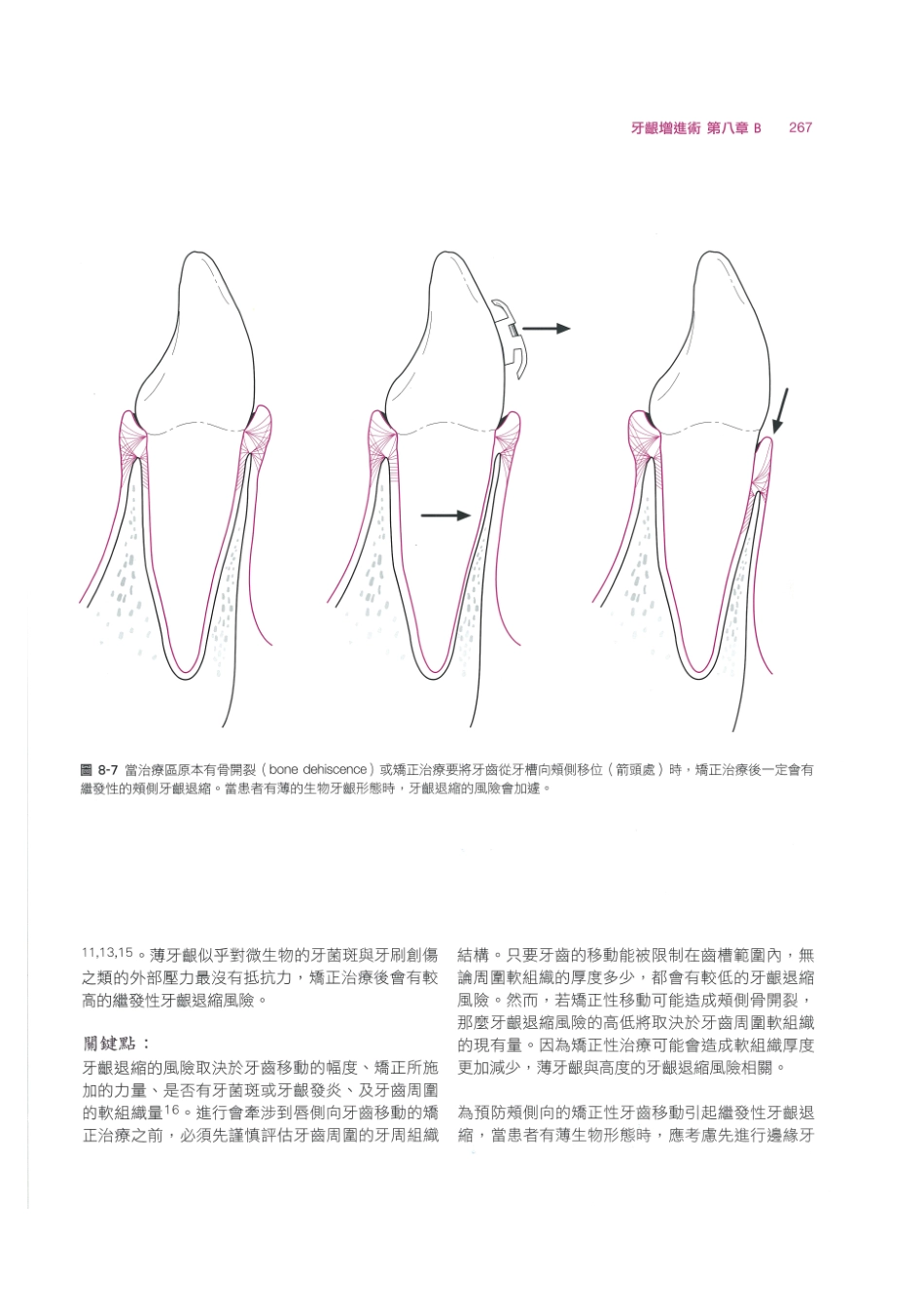 179.牙周整形美容与种植手术_281-288.pdf_第1页