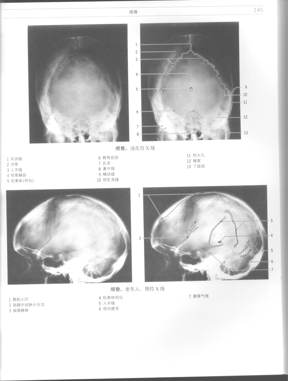 影像解剖学_11724881_145-156.pdf_第3页