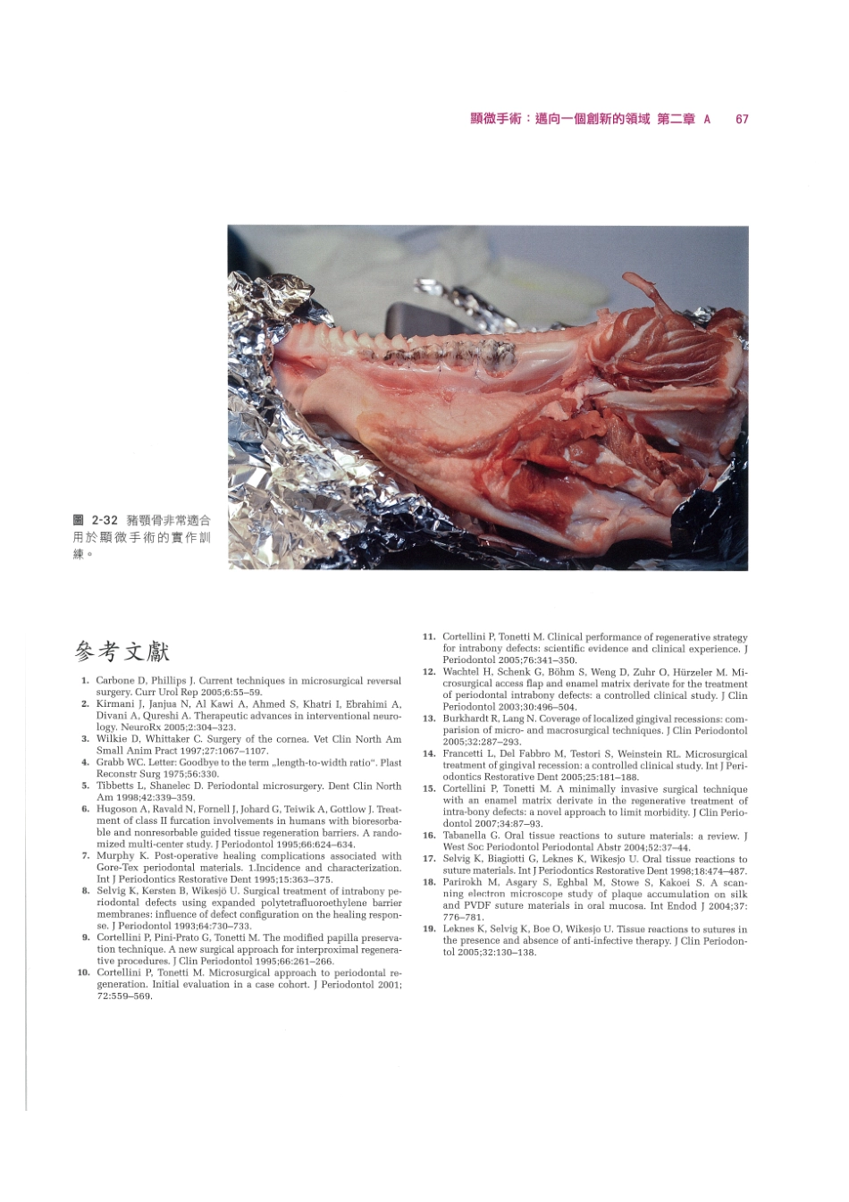 179.牙周整形美容与种植手术_81-88.pdf_第1页