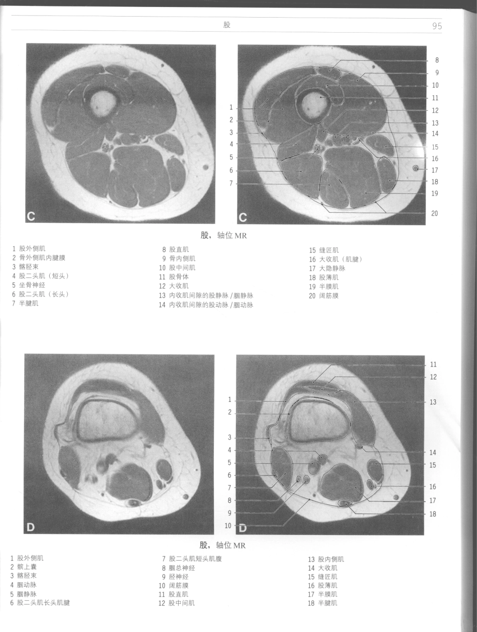 影像解剖学_11724881_97-108.pdf_第1页