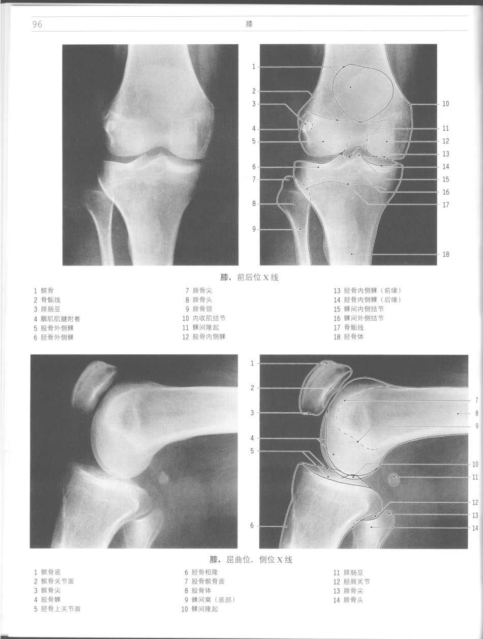 影像解剖学_11724881_97-108.pdf_第2页