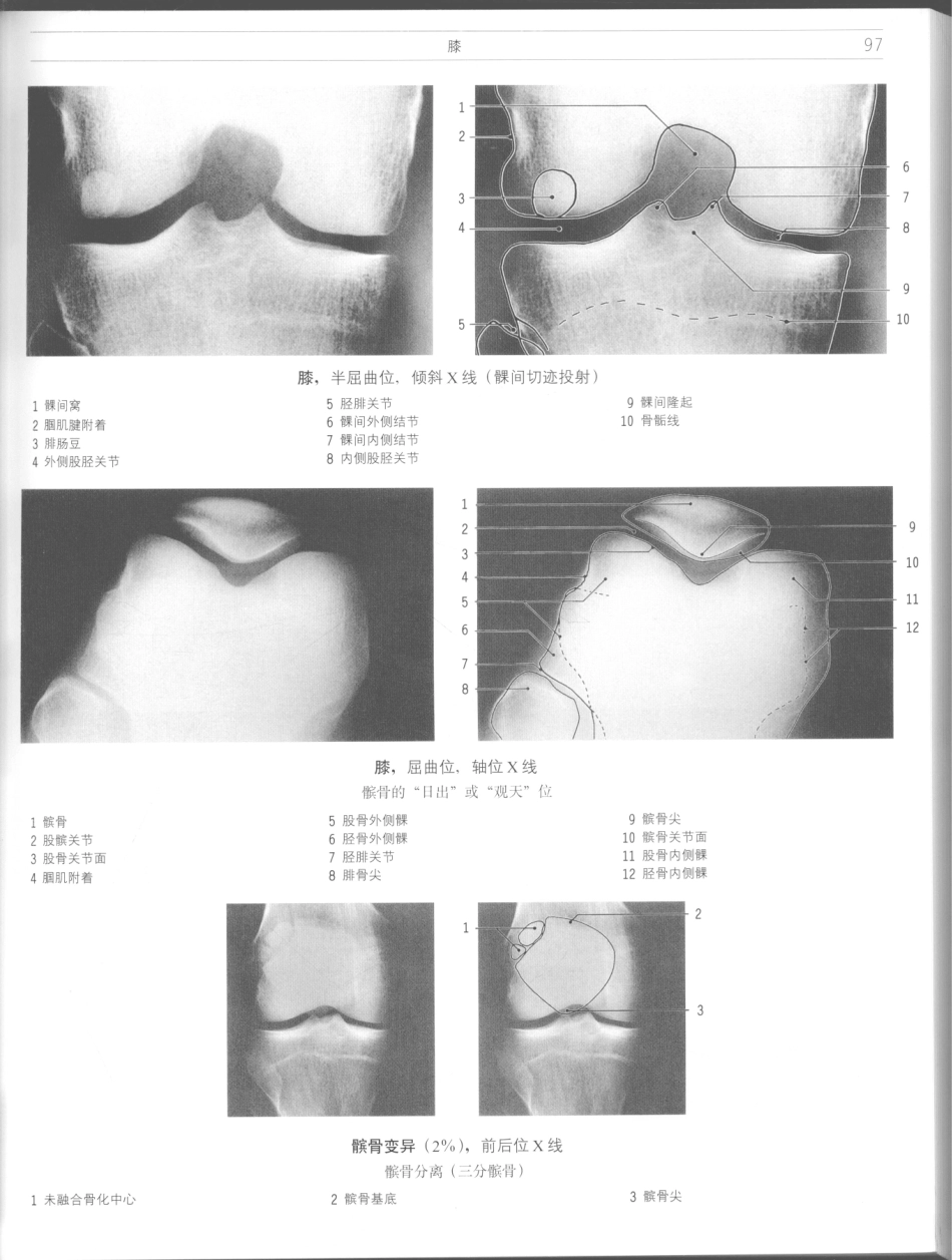 影像解剖学_11724881_97-108.pdf_第3页