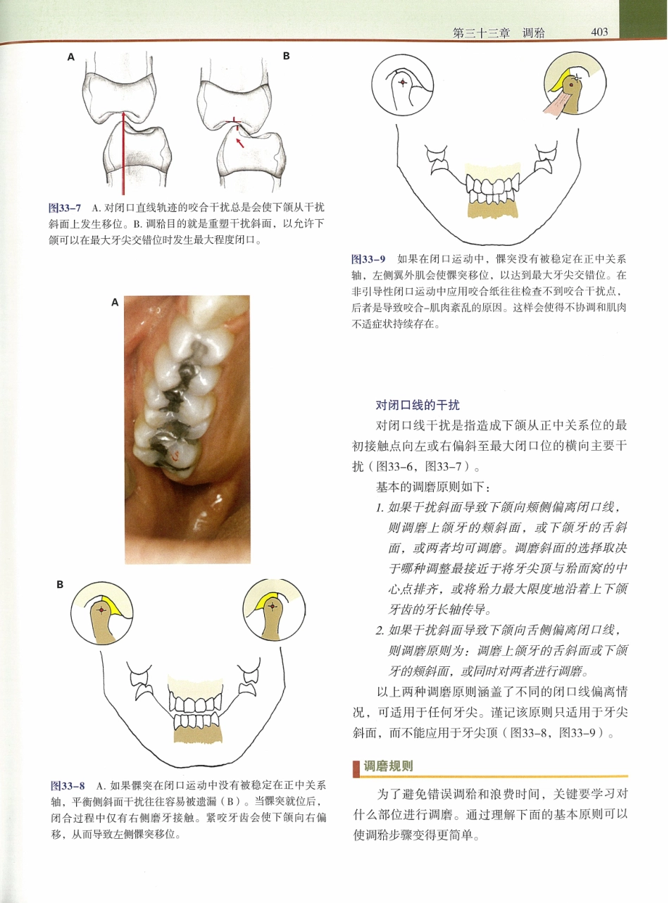 功能牙合学 从颞下颌关节到微笑设计2015年译(彩图)张豪_421-435.pdf_第1页