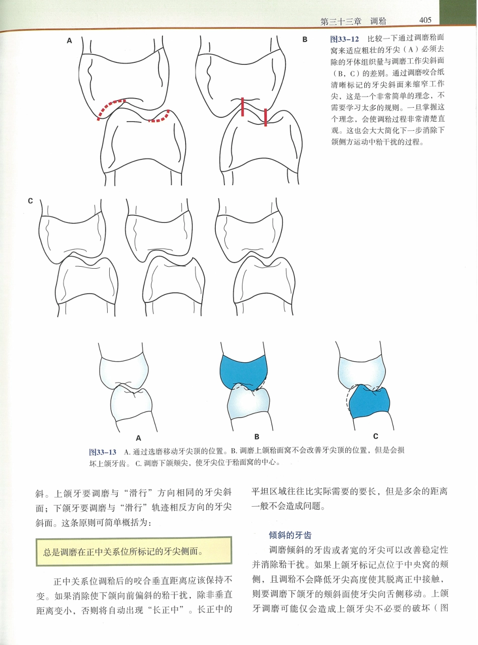 功能牙合学 从颞下颌关节到微笑设计2015年译(彩图)张豪_421-435.pdf_第3页