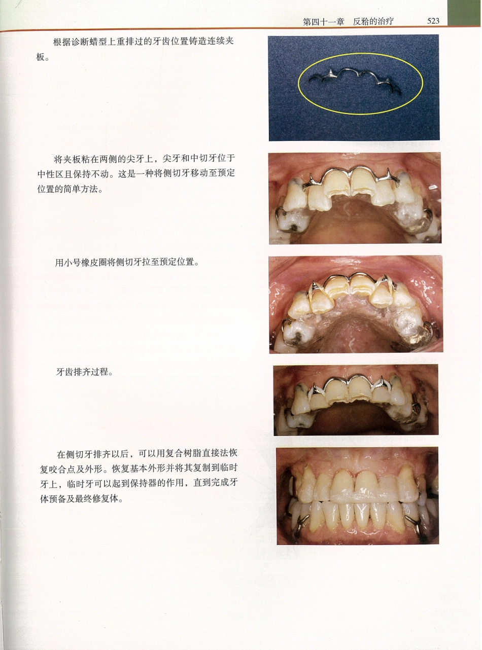功能牙合学 从颞下颌关节到微笑设计2015年译(彩图)张豪_541-555.pdf_第1页