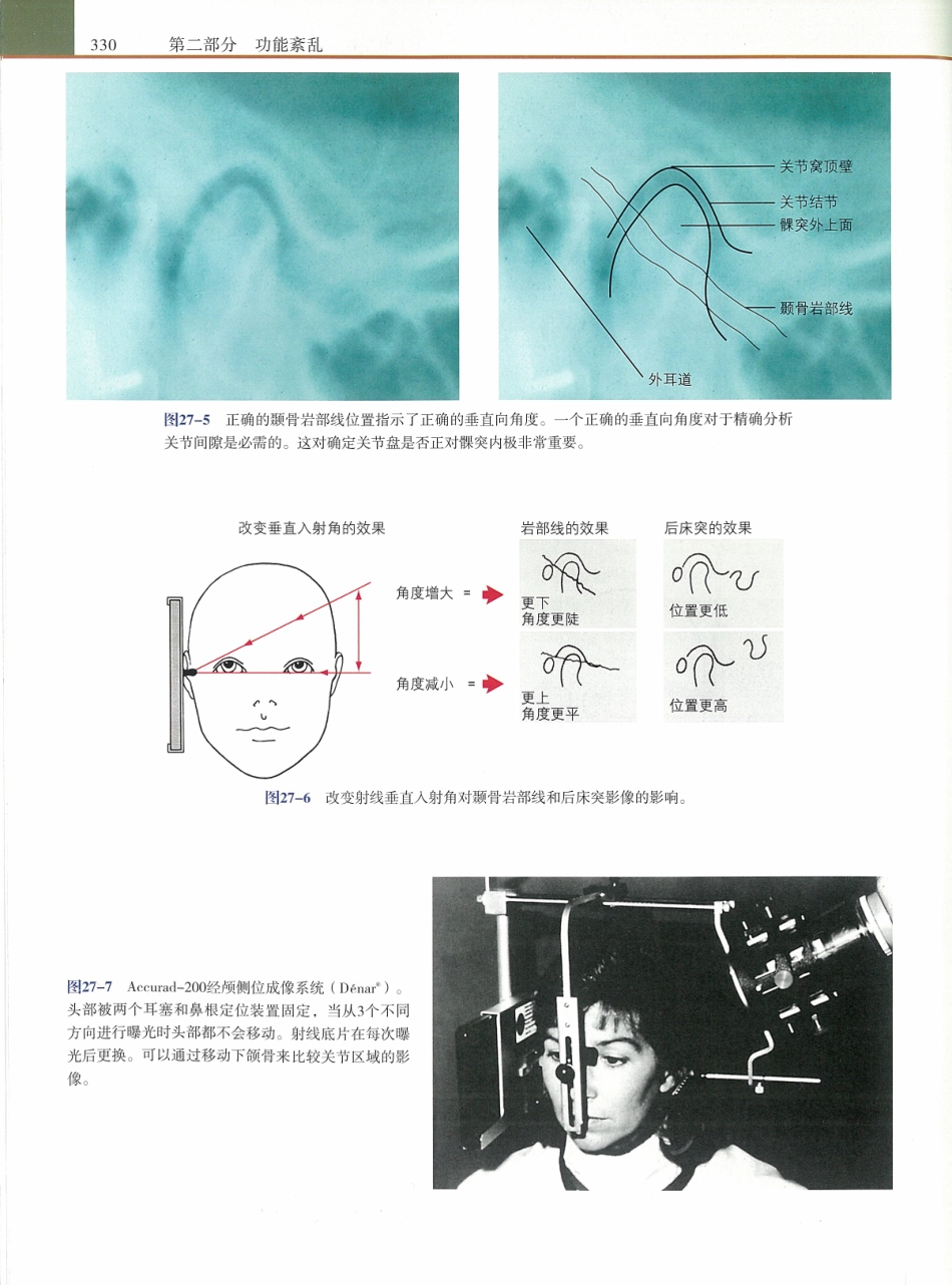 功能牙合学 从颞下颌关节到微笑设计2015年译(彩图)张豪_346-360.pdf_第3页