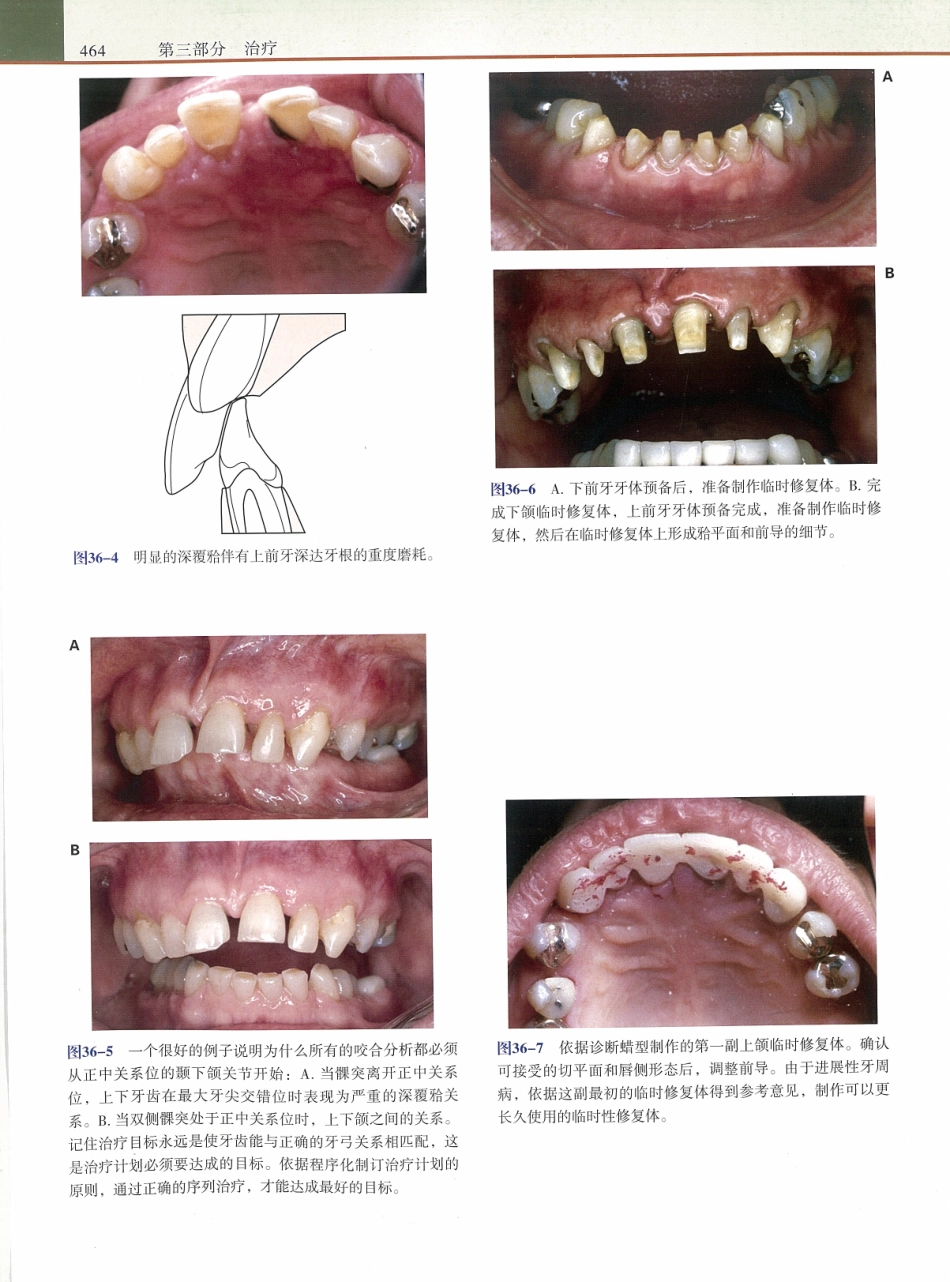 功能牙合学 从颞下颌关节到微笑设计2015年译(彩图)张豪_481-495.pdf_第2页