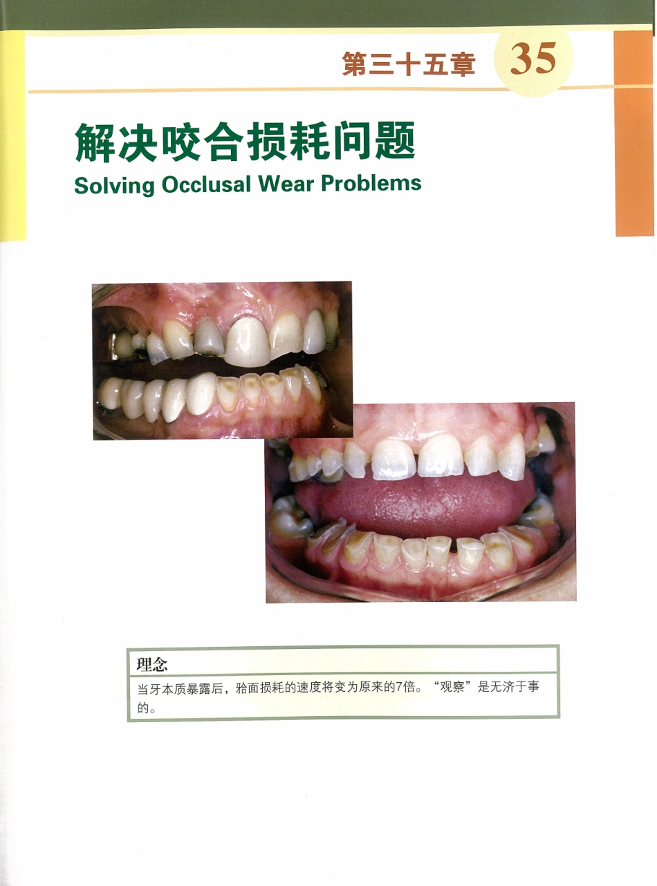 功能牙合学 从颞下颌关节到微笑设计2015年译(彩图)张豪_451-465.pdf_第1页