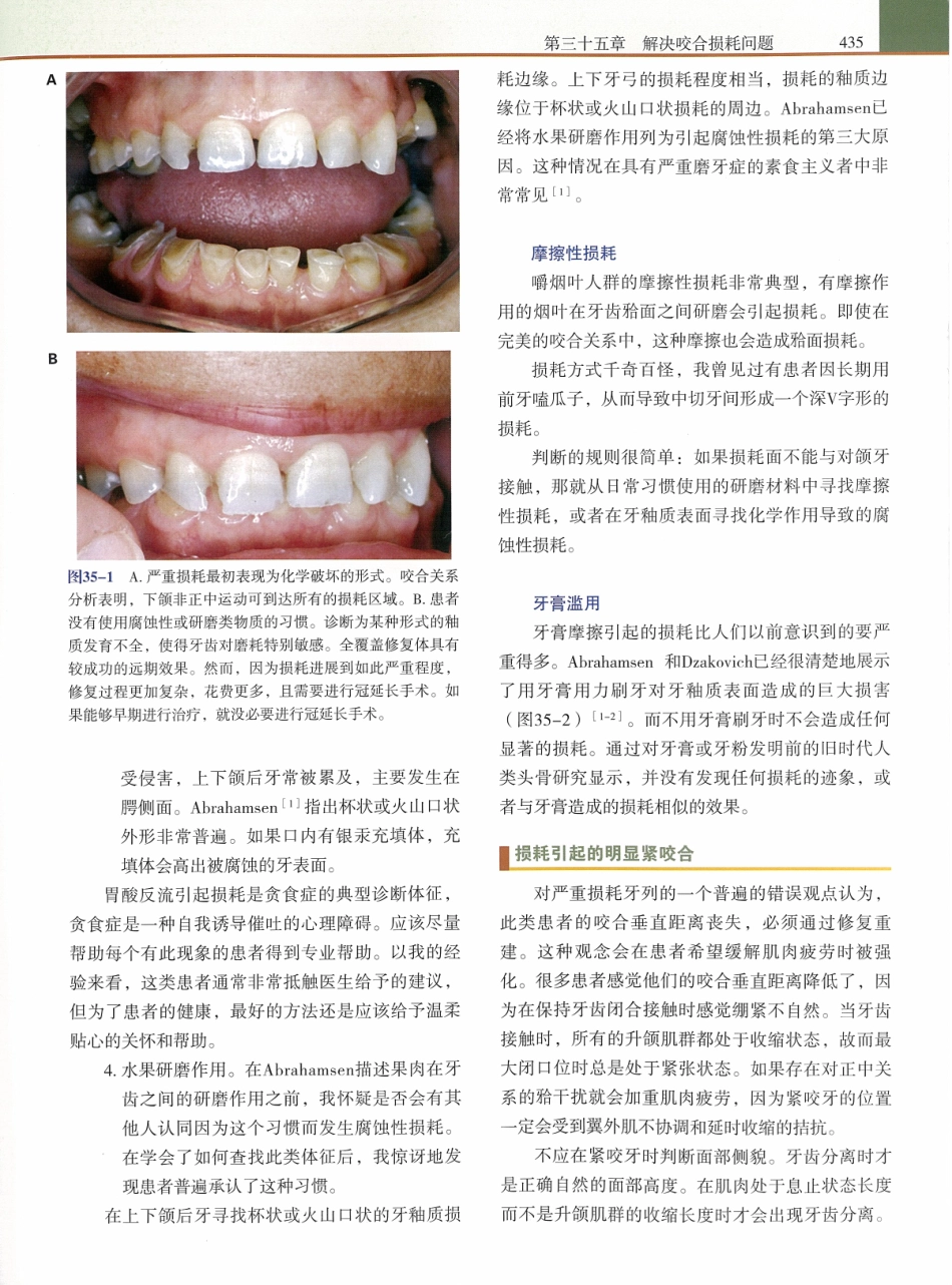 功能牙合学 从颞下颌关节到微笑设计2015年译(彩图)张豪_451-465.pdf_第3页