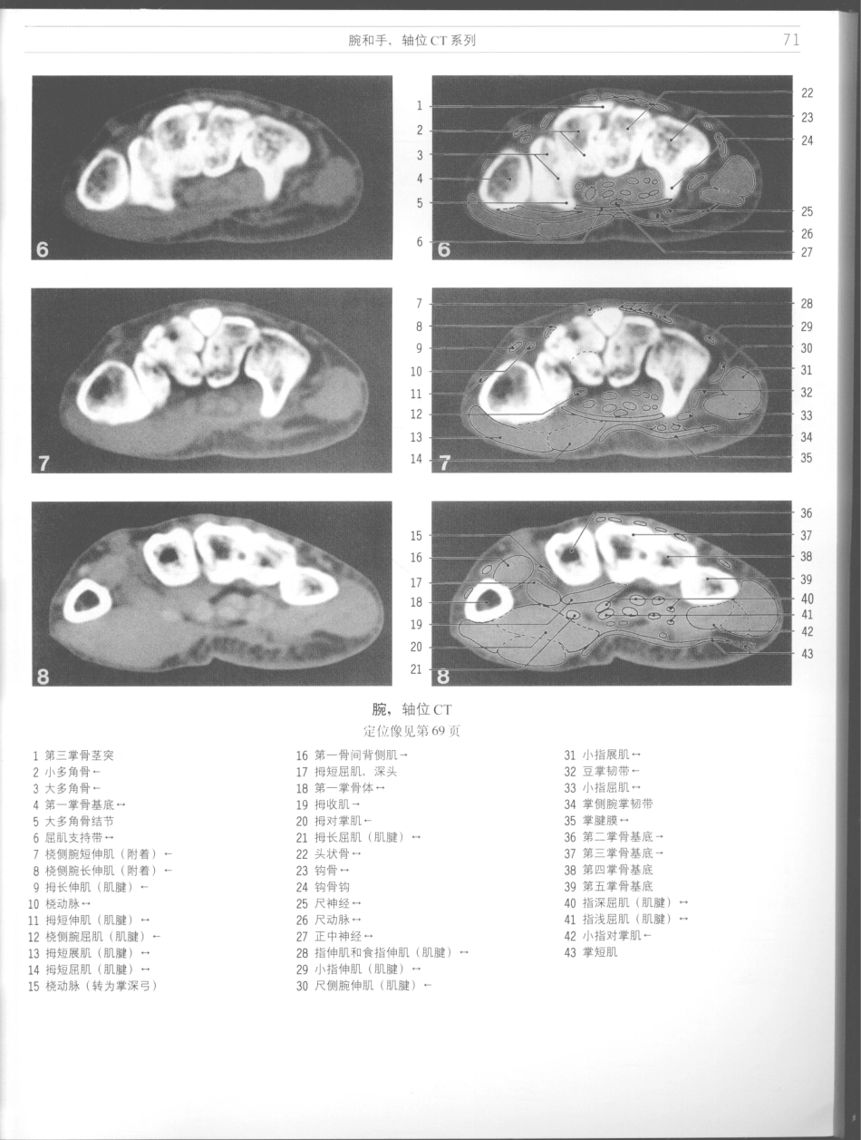 影像解剖学_11724881_73-84.pdf_第1页