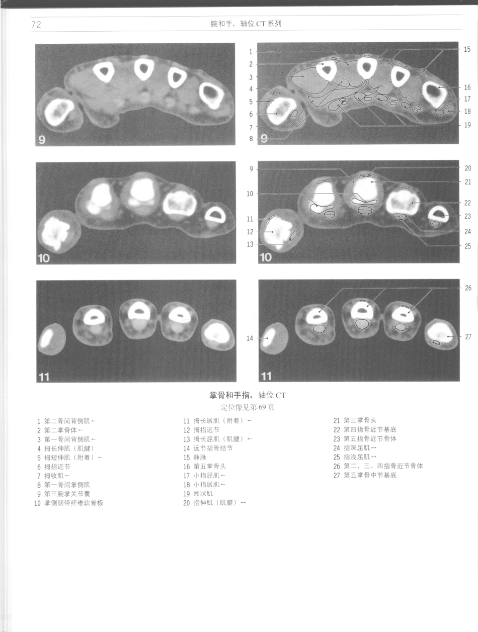 影像解剖学_11724881_73-84.pdf_第2页