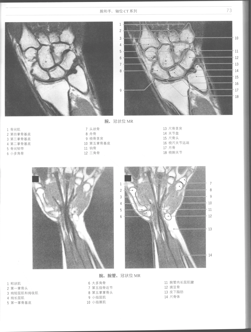 影像解剖学_11724881_73-84.pdf_第3页