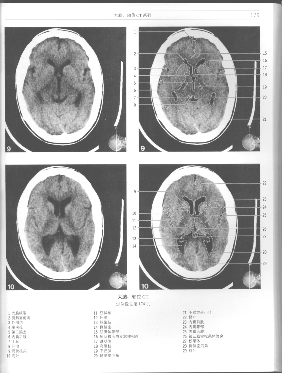影像解剖学_11724881_181-192.pdf_第1页