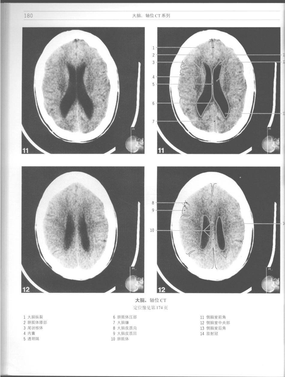 影像解剖学_11724881_181-192.pdf_第2页