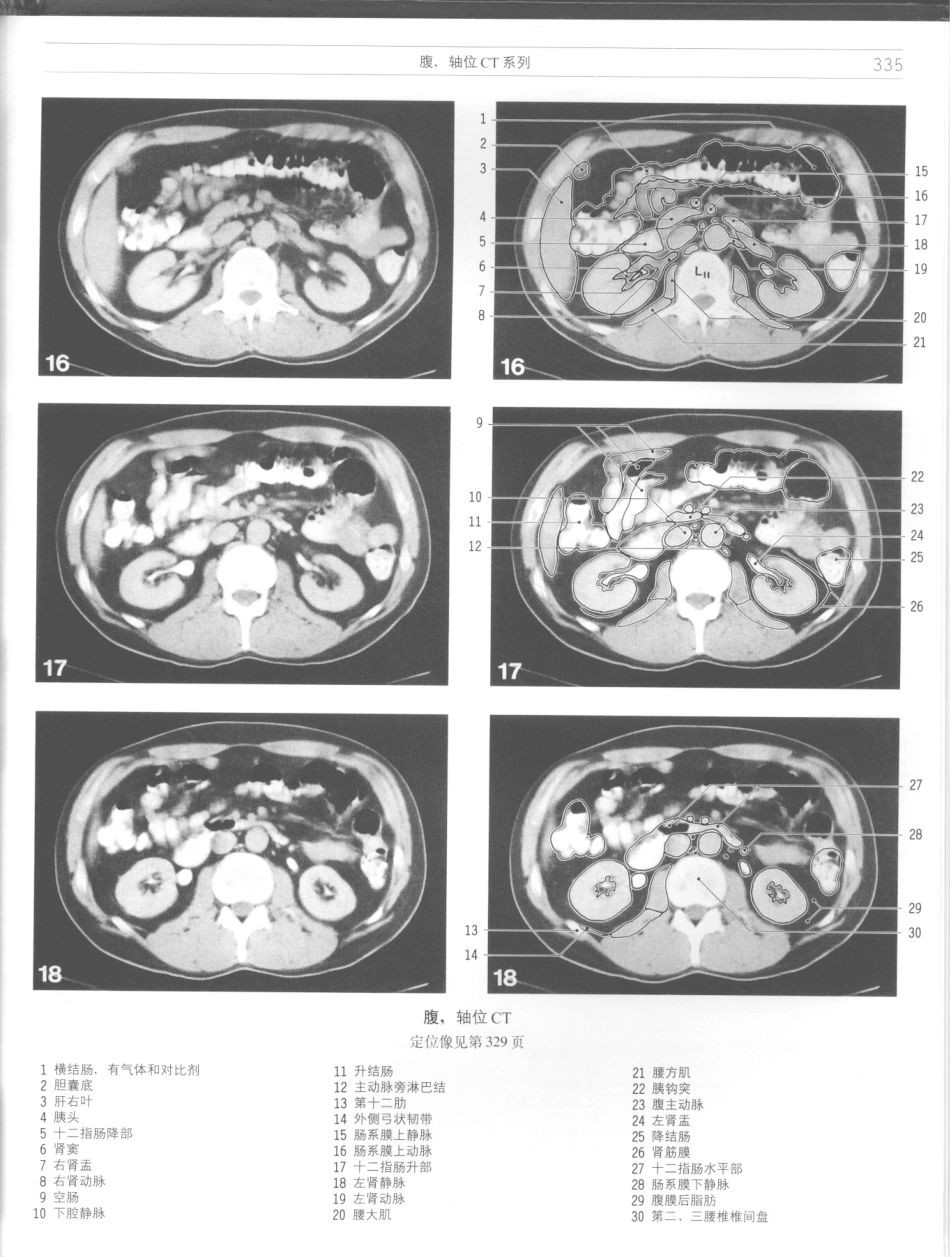 影像解剖学_11724881_337-348.pdf_第1页