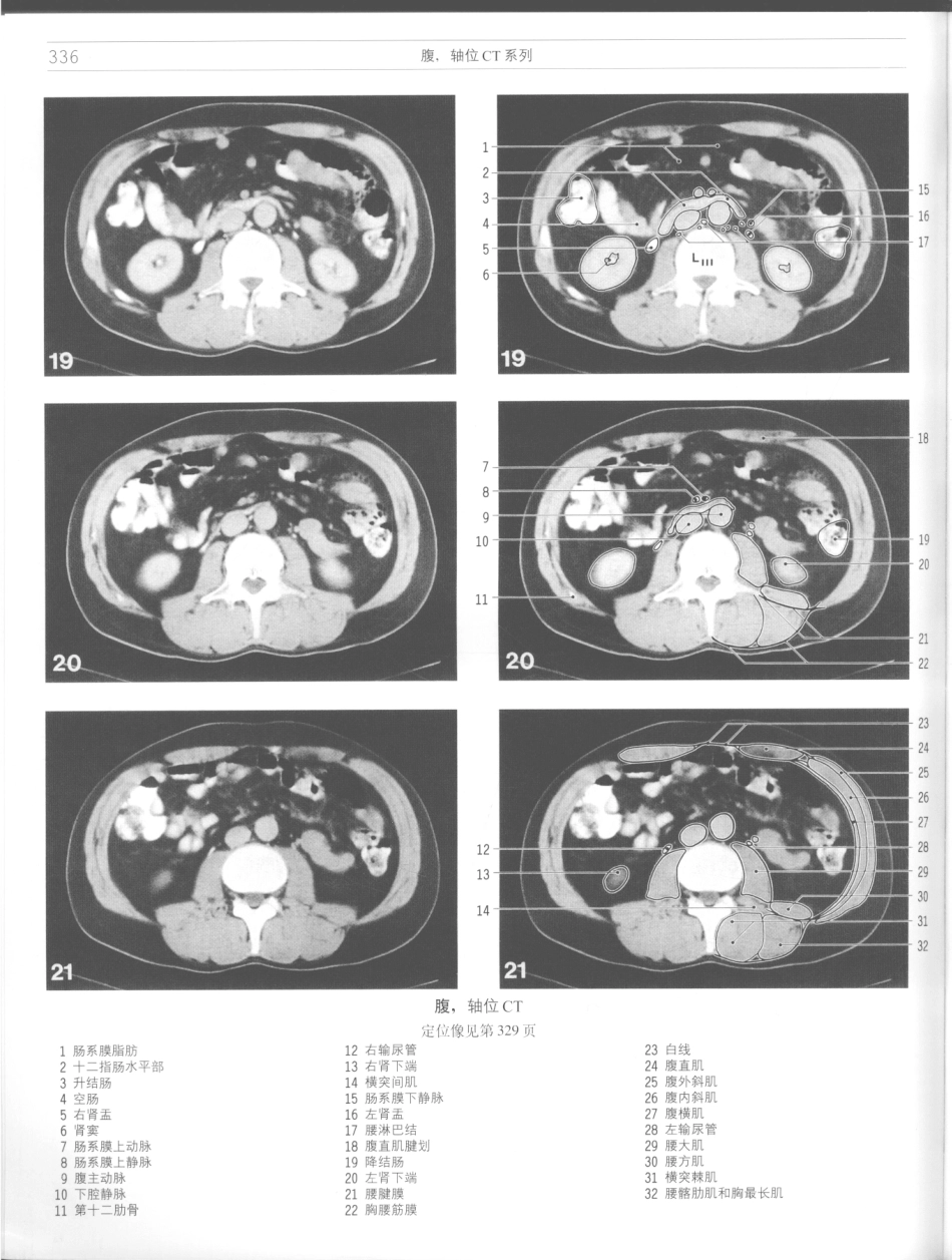 影像解剖学_11724881_337-348.pdf_第2页