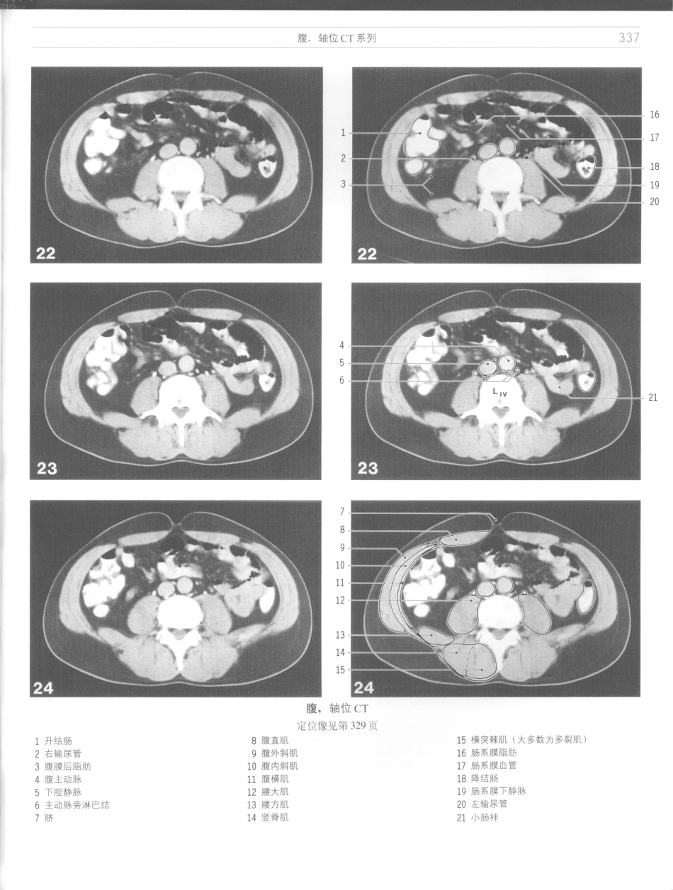 影像解剖学_11724881_337-348.pdf_第3页