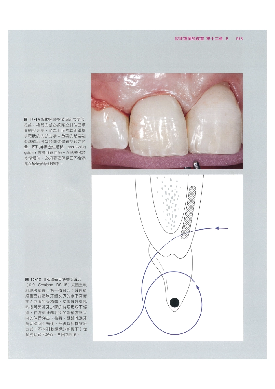 179.牙周整形美容与种植手术_585-592.pdf_第3页