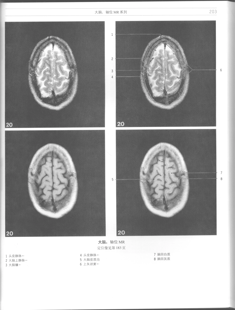 影像解剖学_11724881_205-216.pdf_第1页