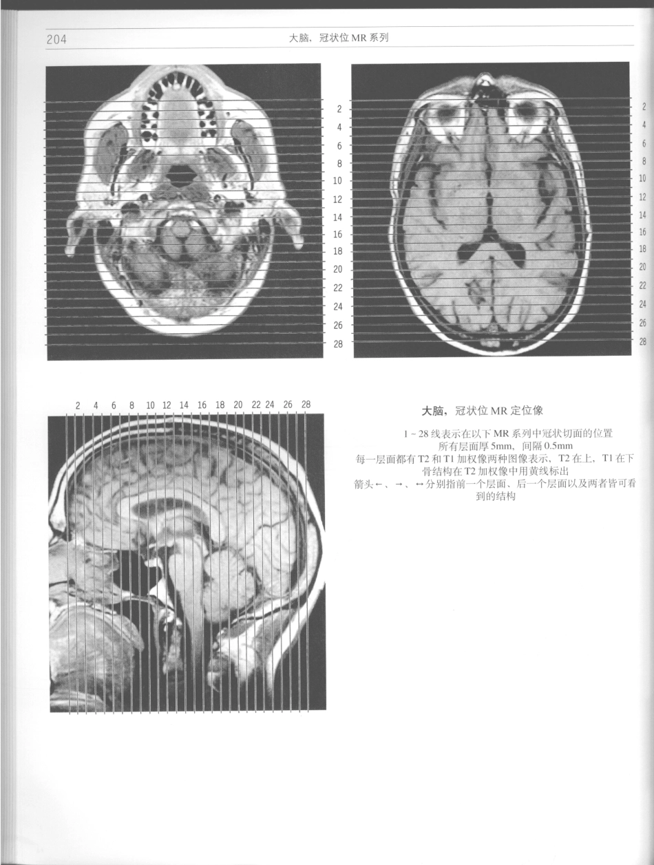 影像解剖学_11724881_205-216.pdf_第2页