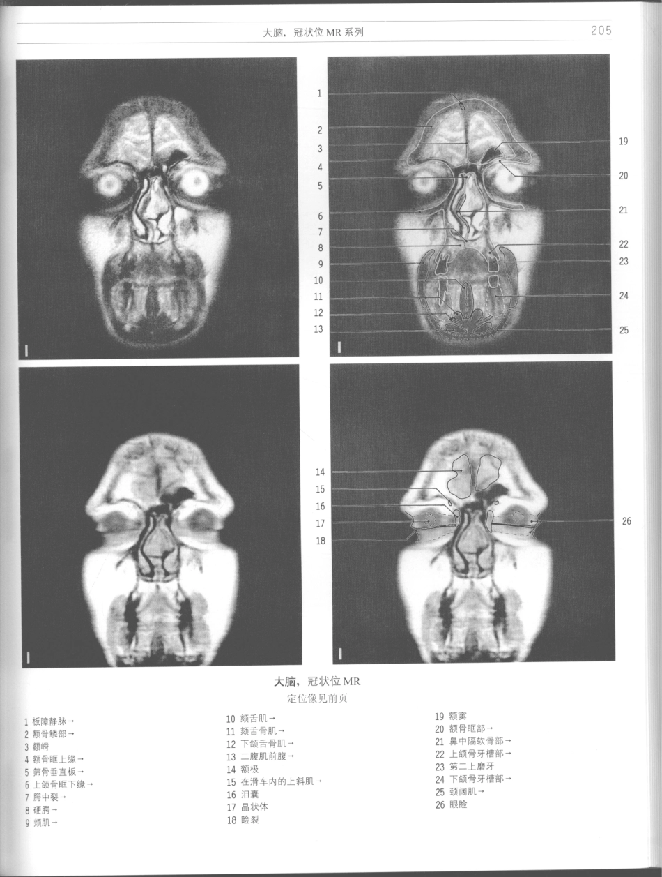 影像解剖学_11724881_205-216.pdf_第3页