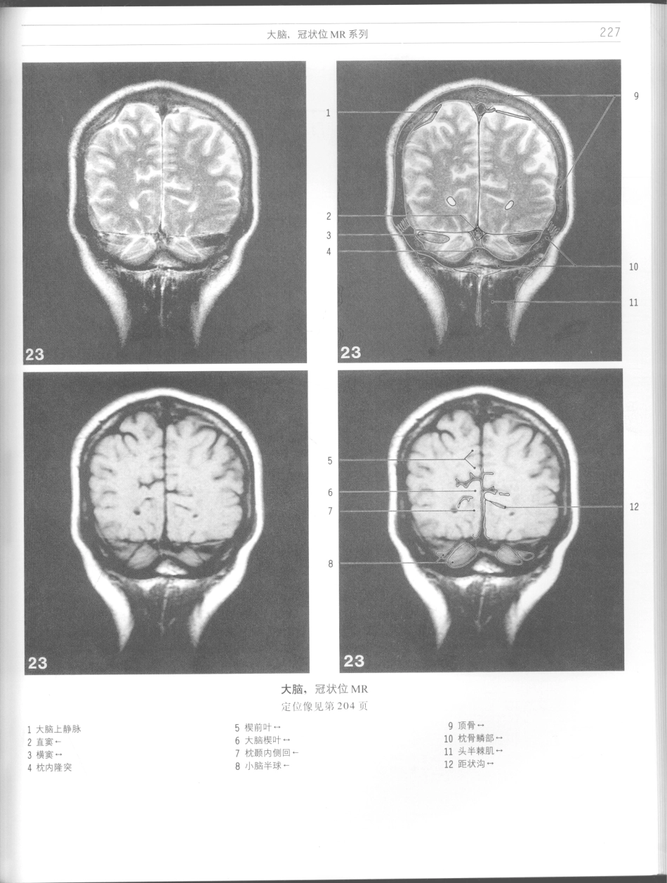 影像解剖学_11724881_229-240.pdf_第1页