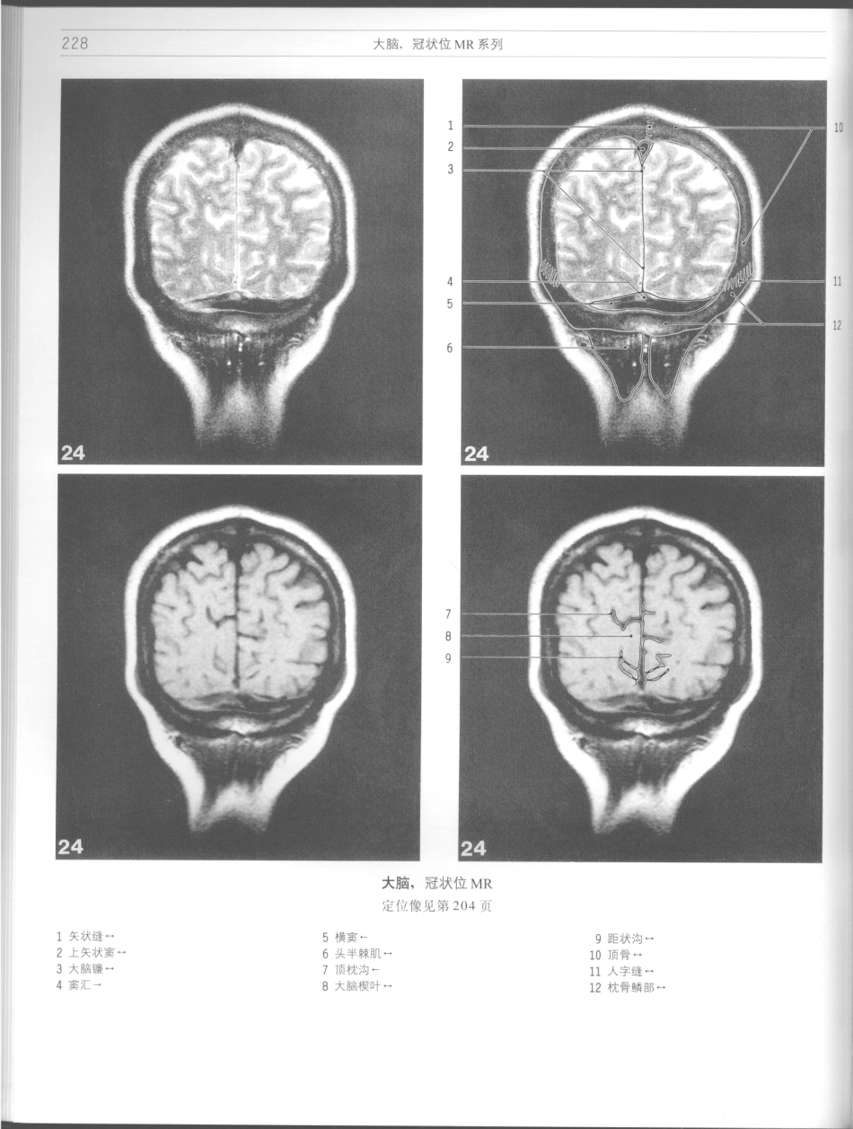 影像解剖学_11724881_229-240.pdf_第2页