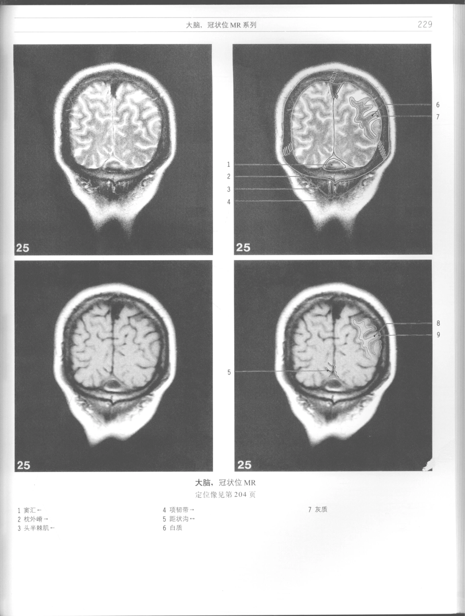 影像解剖学_11724881_229-240.pdf_第3页