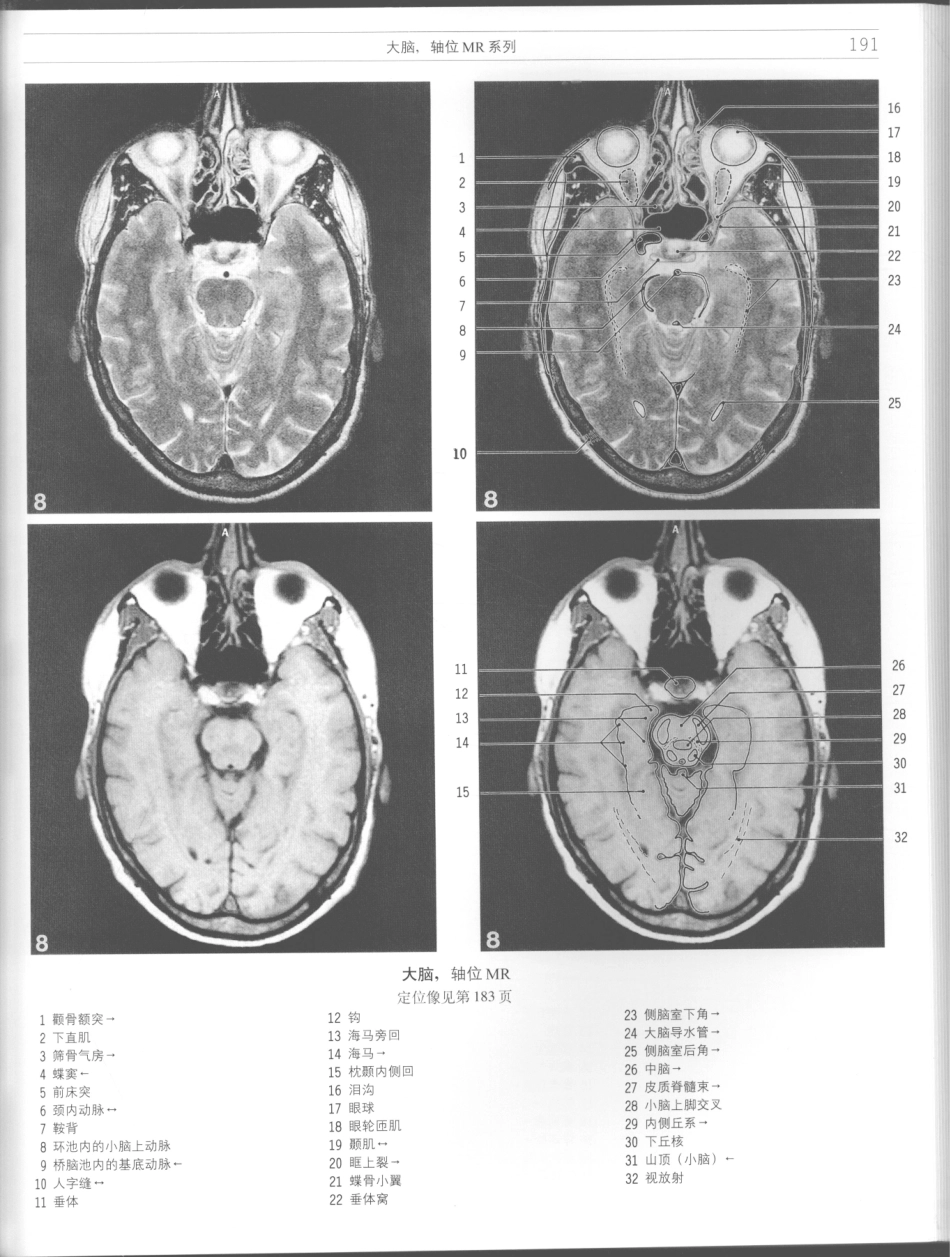 影像解剖学_11724881_193-204.pdf_第1页