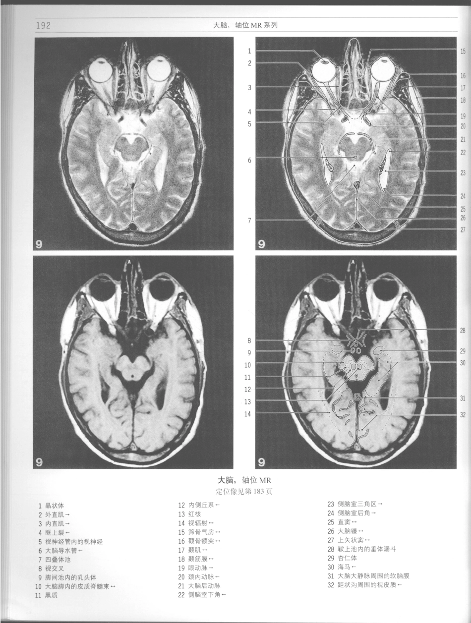影像解剖学_11724881_193-204.pdf_第2页