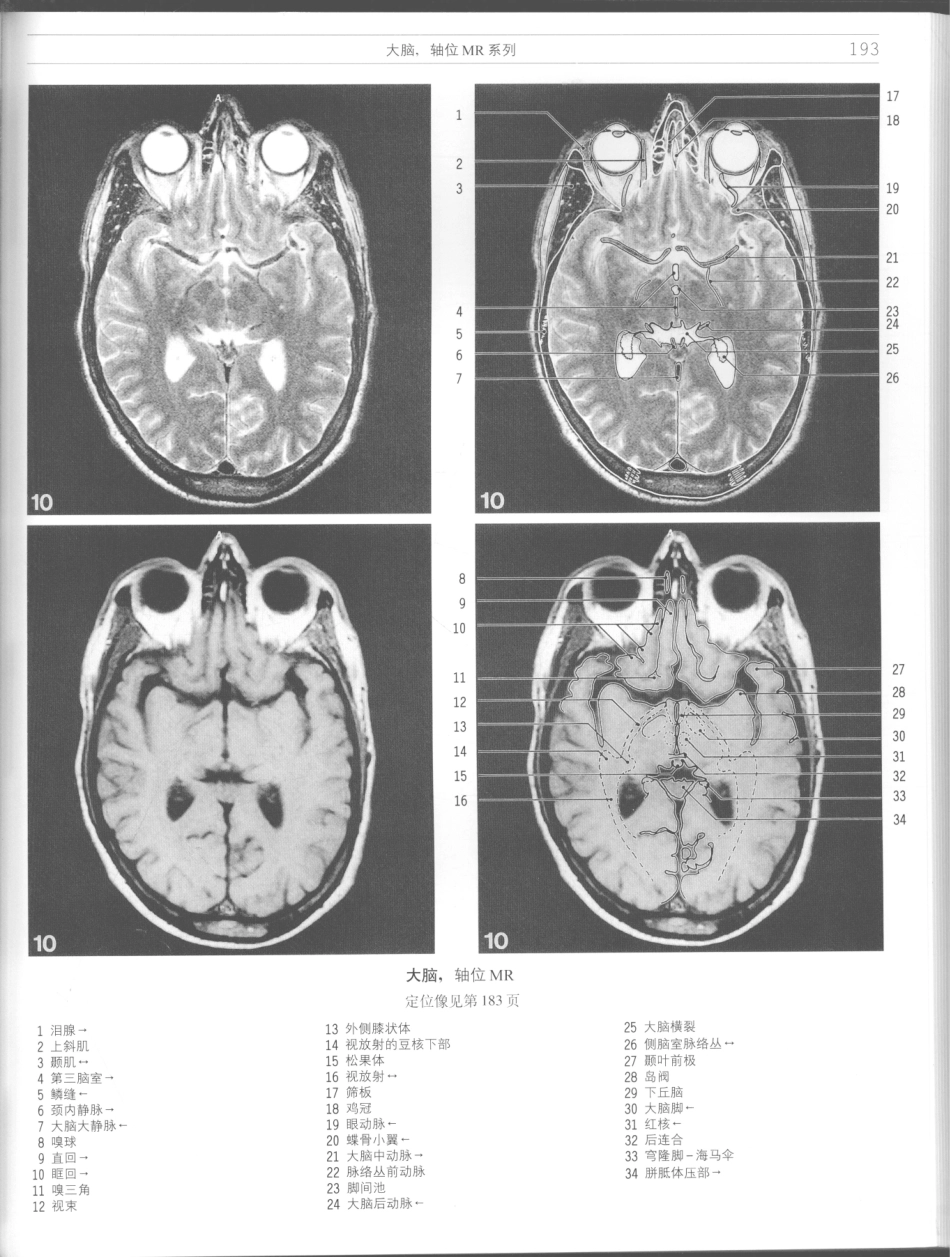 影像解剖学_11724881_193-204.pdf_第3页