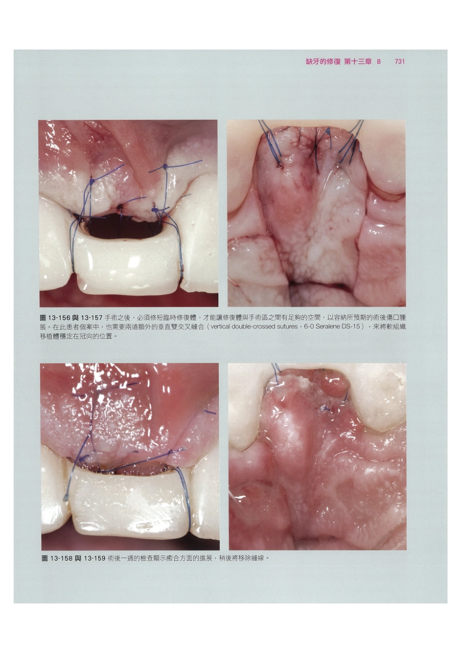 179.牙周整形美容与种植手术_745-752.pdf_第1页