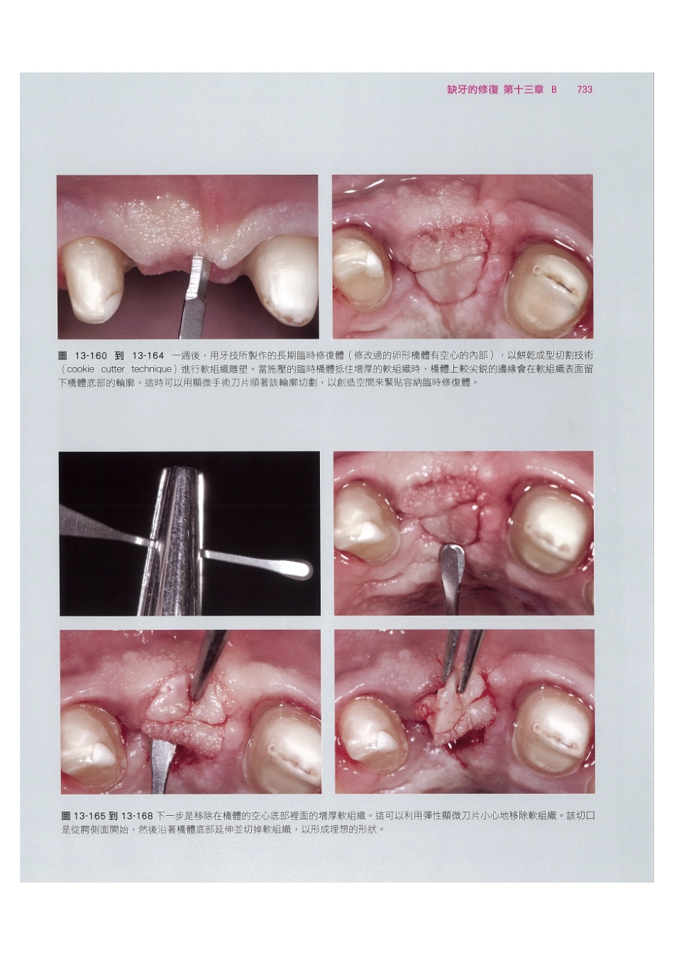 179.牙周整形美容与种植手术_745-752.pdf_第3页