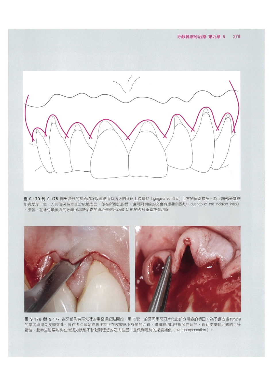 179.牙周整形美容与种植手术_393-400.pdf_第1页