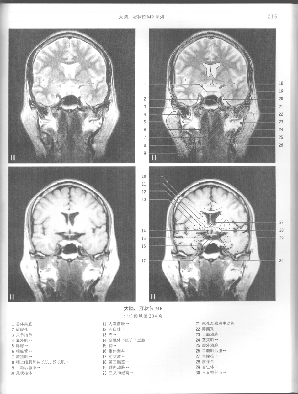 影像解剖学_11724881_217-228.pdf_第1页