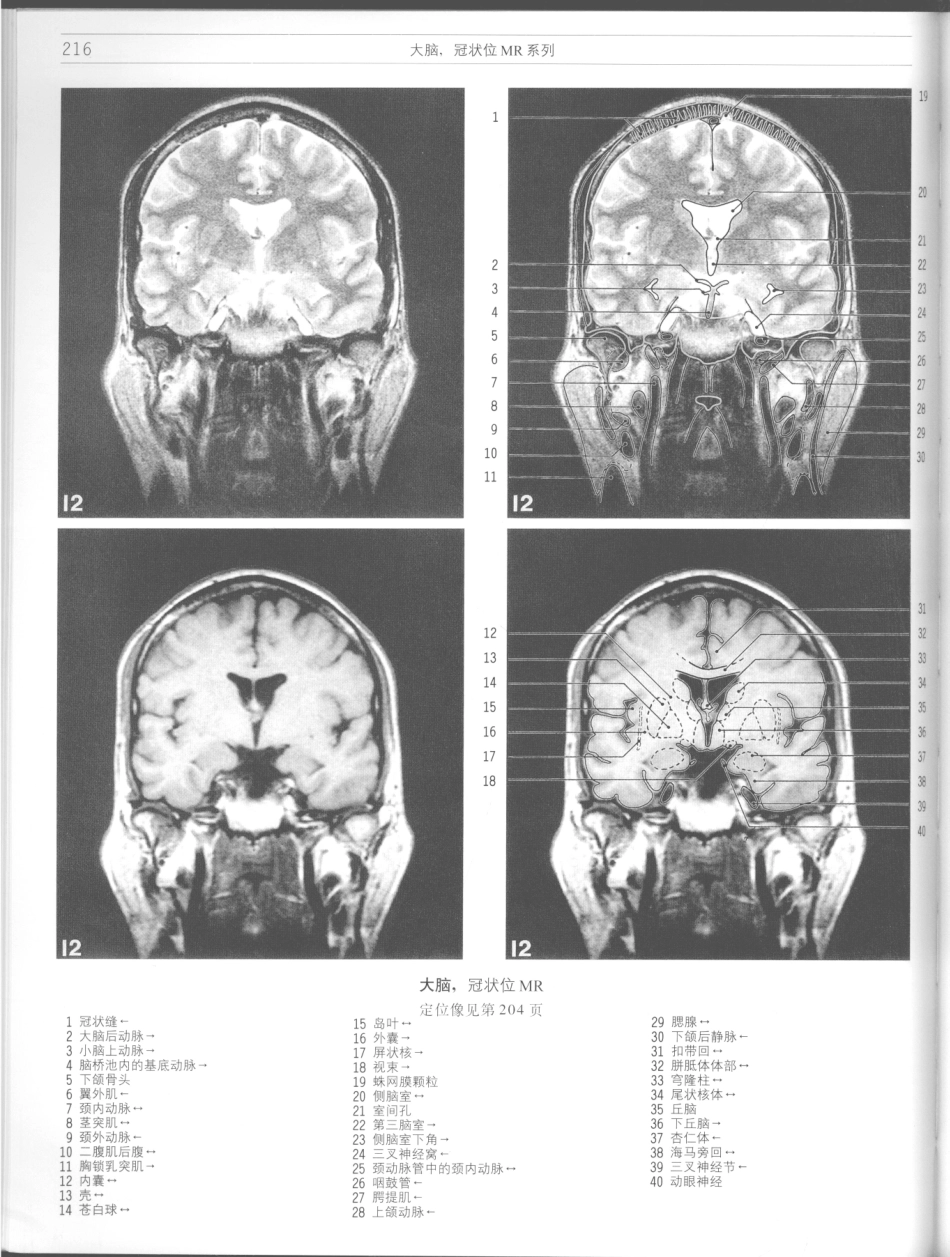 影像解剖学_11724881_217-228.pdf_第2页